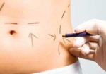 cirurgia-plastica-itaim-1382627782