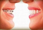 plano-odontologico-itaim-1382726520